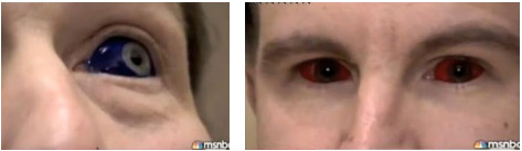 O branco dos olhos tatuados